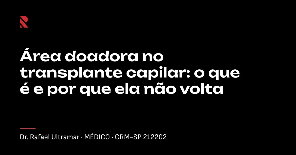 Título "Área doadora no transplante capilar: o que é e por que ela não volta" sobre fundo preto, com o nome e o CRM do Dr. Rafael Ultramar