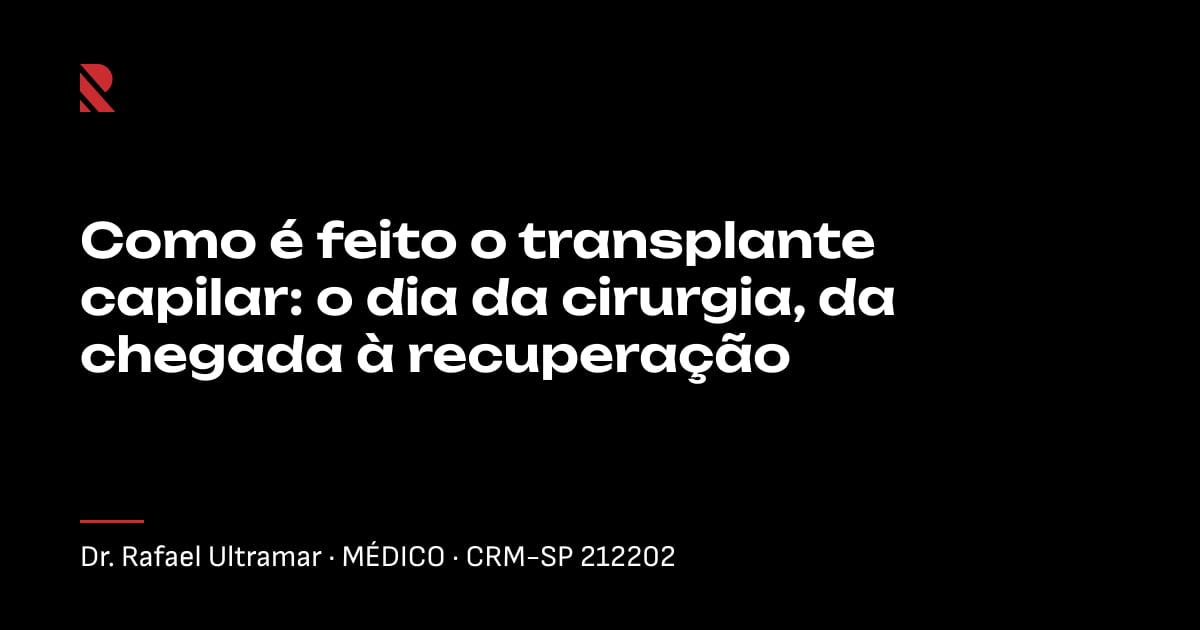 Título "Como é feito o transplante capilar: o dia da cirurgia, da chegada à recuperação" sobre fundo preto, com o nome e o CRM do Dr. Rafael Ultramar
