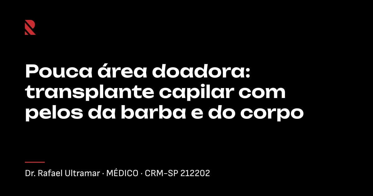 Título "Pouca área doadora: transplante capilar com pelos da barba e do corpo" sobre fundo preto, com o nome e o CRM do Dr. Rafael Ultramar