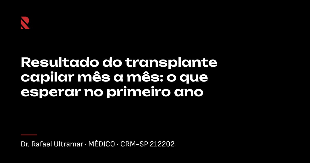 Título "Resultado do transplante capilar mês a mês: o que esperar no primeiro ano" sobre fundo preto, com o nome e o CRM do Dr. Rafael Ultramar