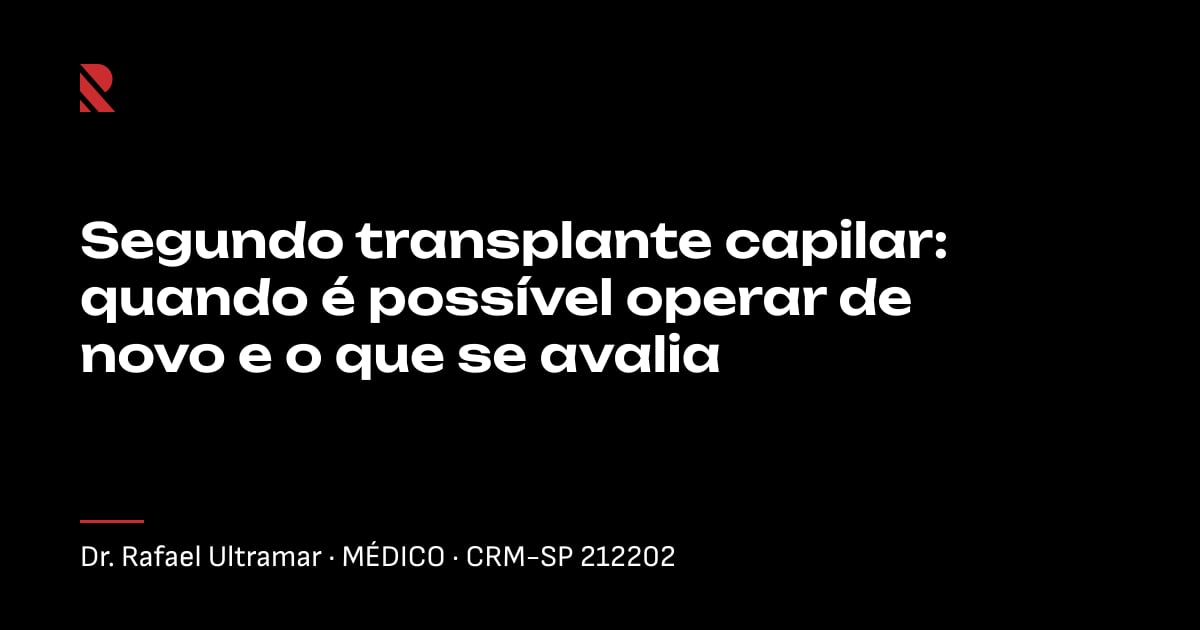 Título "Segundo transplante capilar: quando é possível operar de novo e o que se avalia" sobre fundo preto, com o nome e o CRM do Dr. Rafael Ultramar