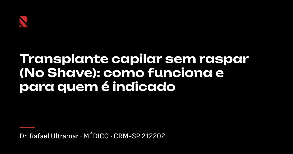 Título "Transplante capilar sem raspar (No Shave): como funciona e para quem é indicado" sobre fundo preto, com o nome e o CRM do Dr. Rafael Ultramar
