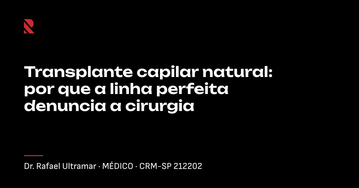 Título "Transplante capilar natural: por que a linha perfeita denuncia a cirurgia" sobre fundo preto, com o nome e o CRM do Dr. Rafael Ultramar